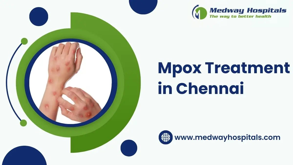 Mpox Treatment in Chennai