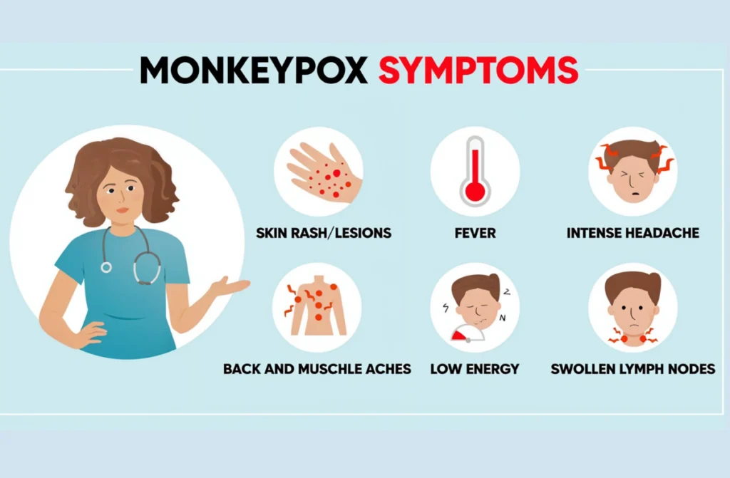 Mpox Treatment in Chennai