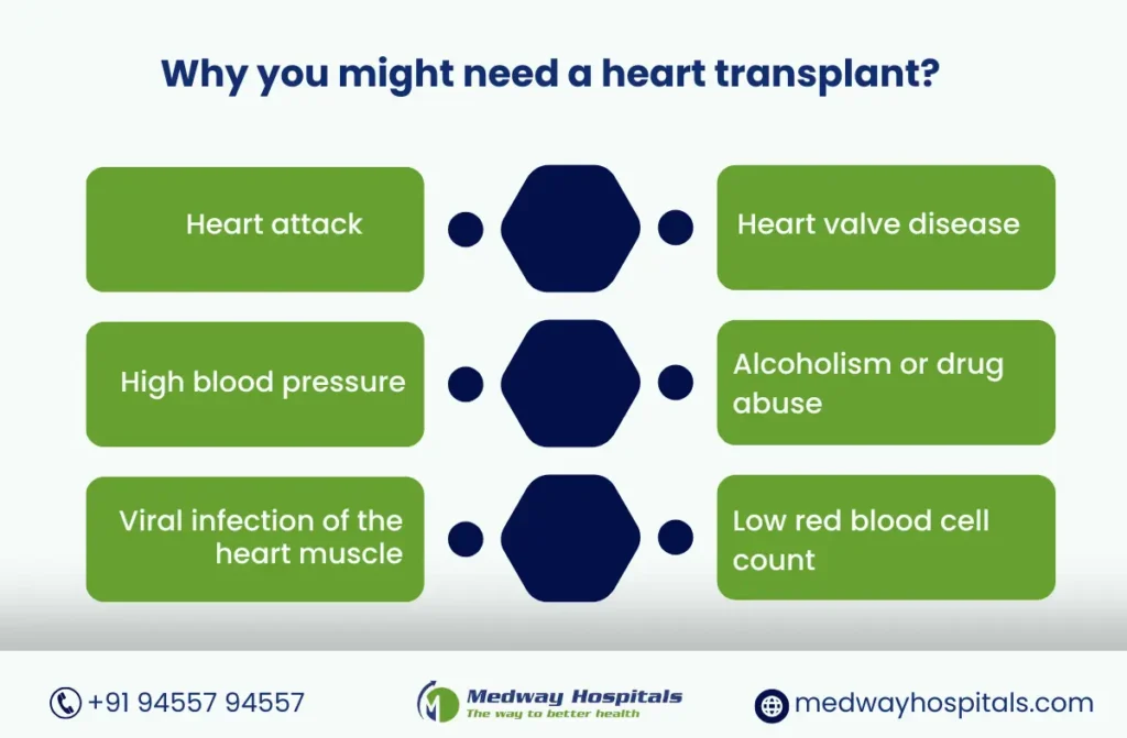 Heart Transplantation in Chennai | Medway Hospitals