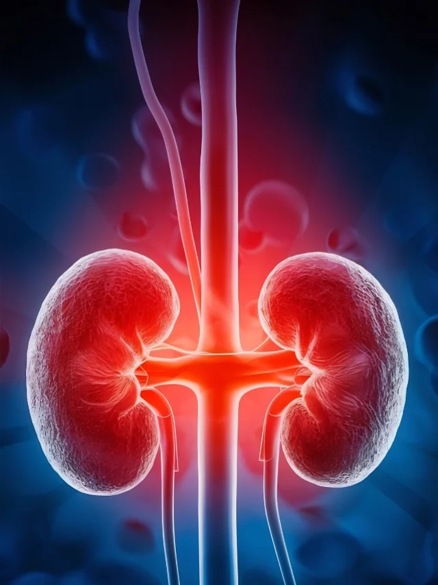 Treatment for Kidney Stones