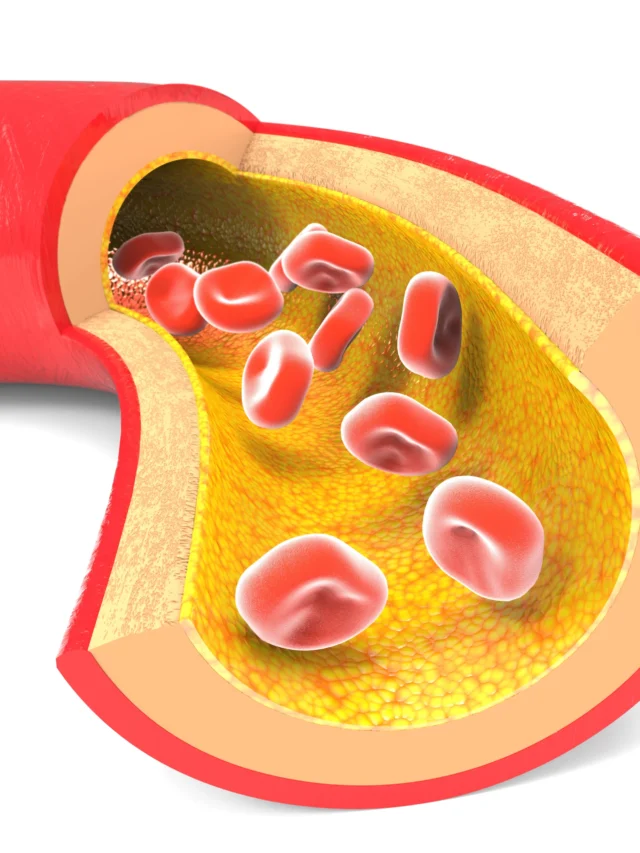 normal-artery-with-red-blood-cells