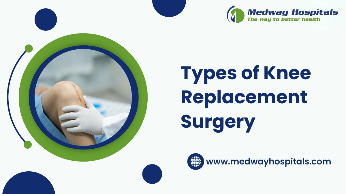 Types of Knee Replacement Surgery