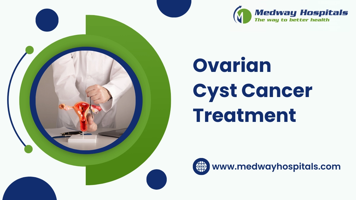 ovarian cyst cancer treatment