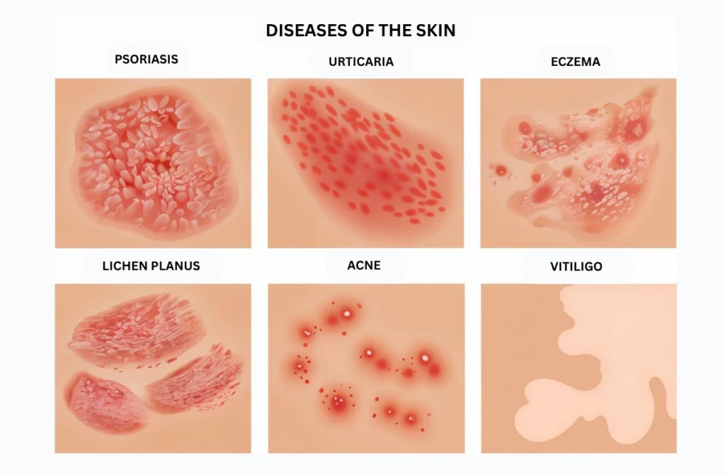 Top Dermatology Hospital in Chennai
