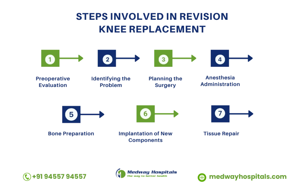 revision knee replacement surgery