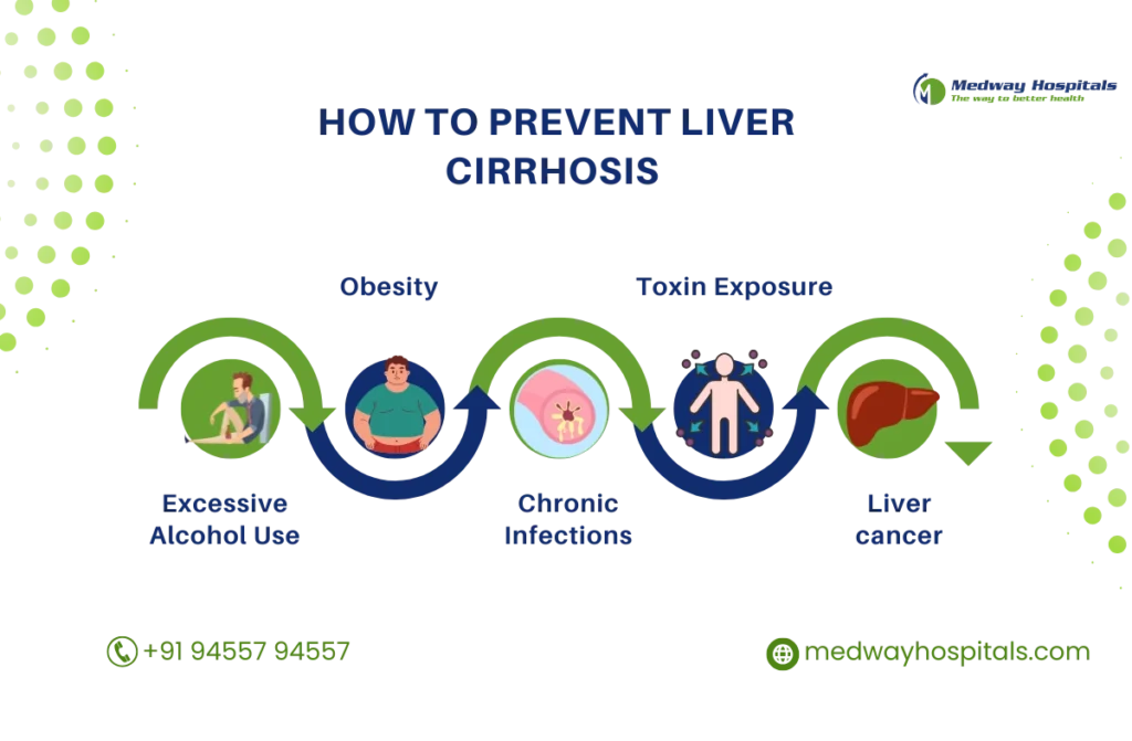 How to Prevent Liver Cirrhosis