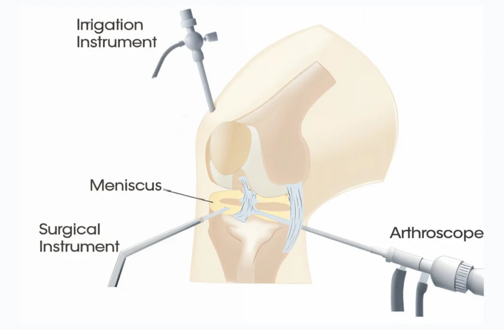 Orthopedic treatment in chennai