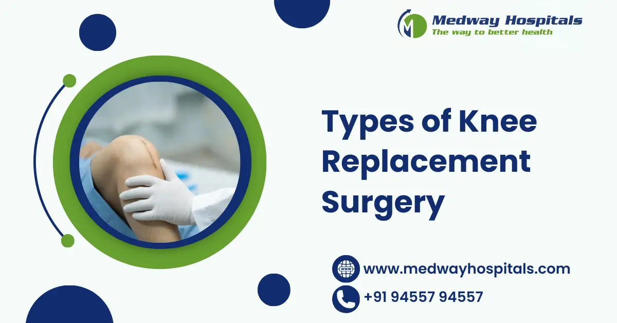 Types of Knee Replacement Surgery