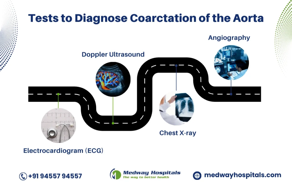 3 sign aortic coarctation