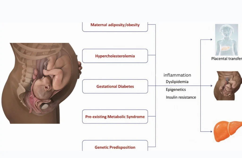 Fatty Liver While Pregnant
