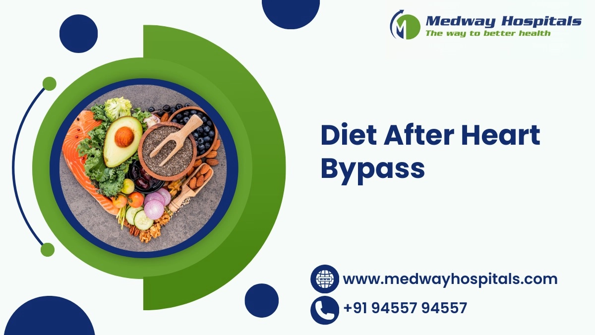 Diet After Heart Bypass