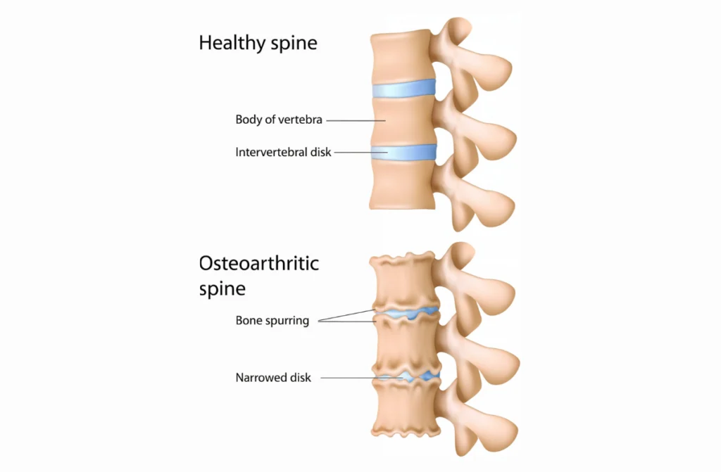 Orthopedic Physical Therapy