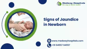  Signs of Jaundice in Newborn