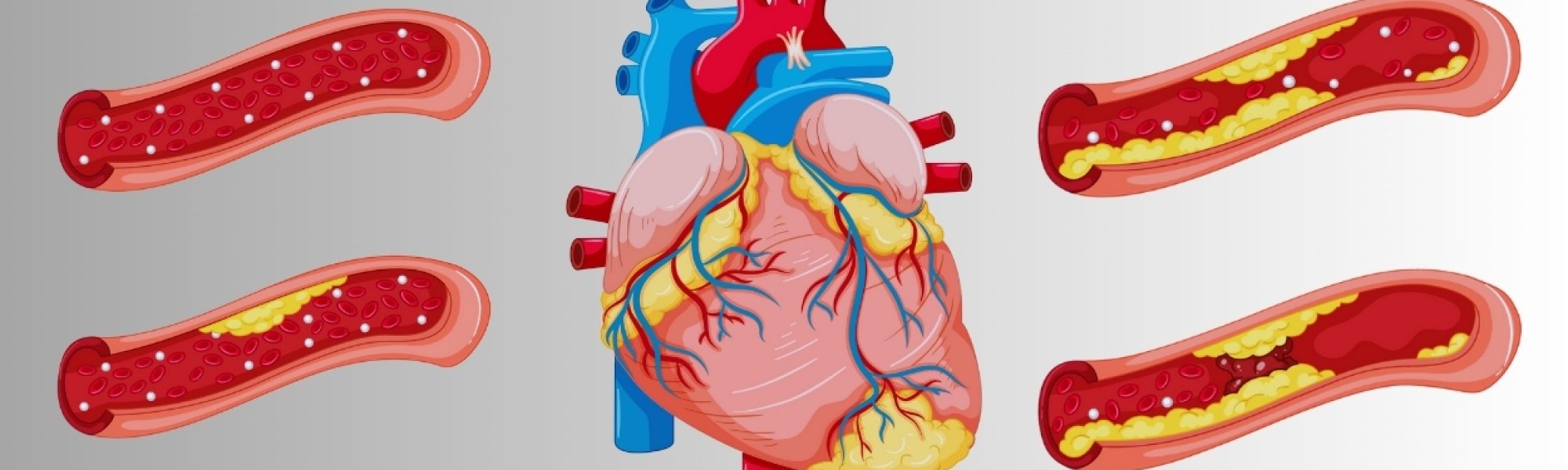 Congenital heart failure treatment