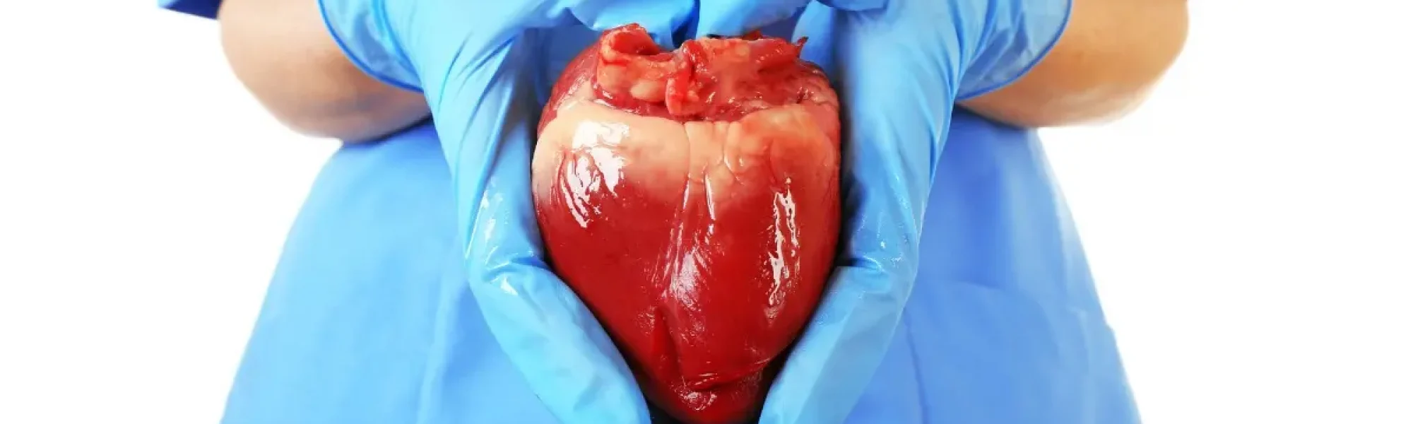 Heart Transplantation in Chennai