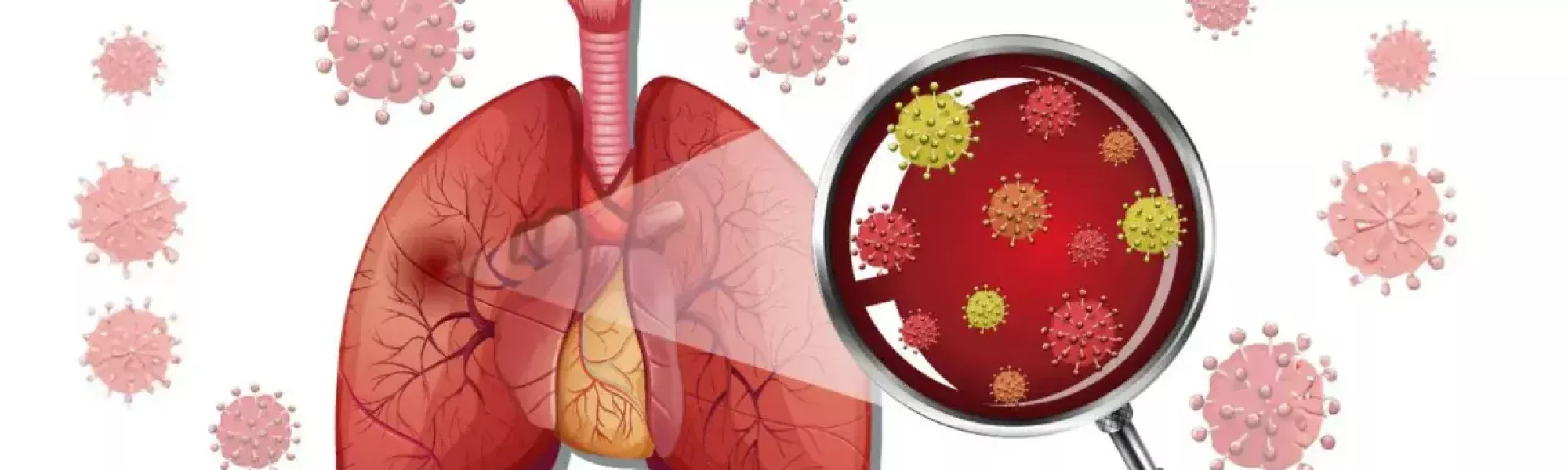 treatment for pneumonia in lungs | Medway Hospitals